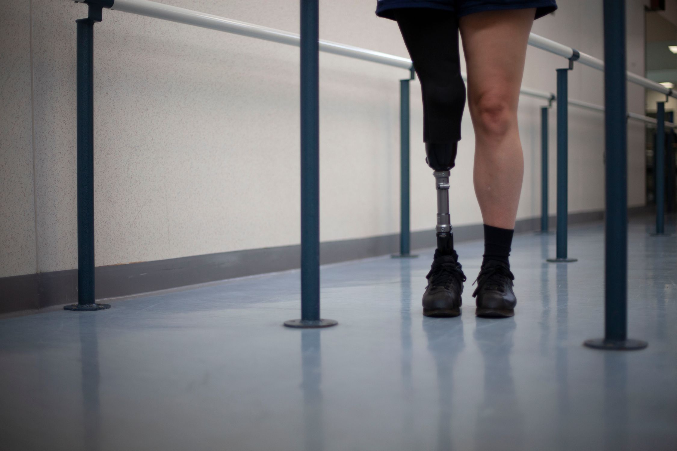 The photo shows the lower half of an individual walking with the aid of a prosthetic leg. The person is wearing shorts, a single black sock, and black shoes. The flooring is a smooth, reflective surface, and there are handrails alongside, suggesting a rehabilitation facility or a space designed for physical therapy. The focus on the prosthetic leg highlights themes of mobility, recovery, and adaptive technology.