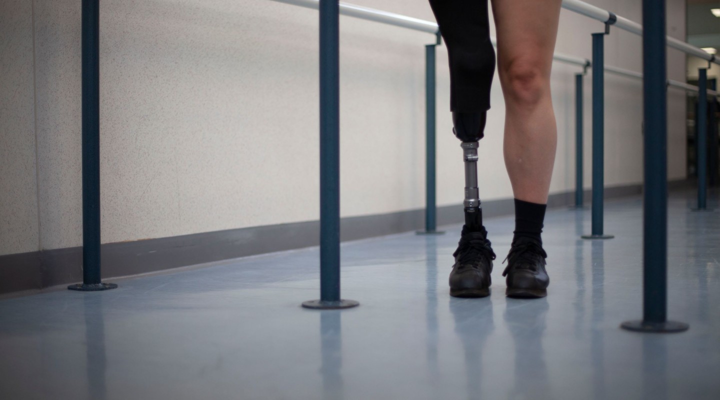 The photo shows the lower half of an individual walking with the aid of a prosthetic leg. The person is wearing shorts, a single black sock, and black shoes. The flooring is a smooth, reflective surface, and there are handrails alongside, suggesting a rehabilitation facility or a space designed for physical therapy. The focus on the prosthetic leg highlights themes of mobility, recovery, and adaptive technology.